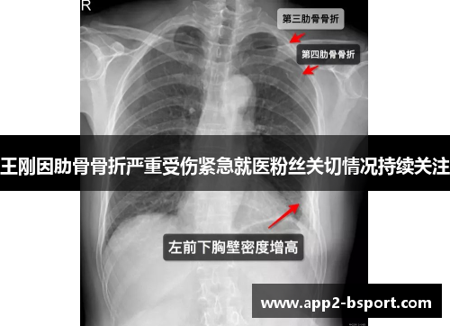 王刚因肋骨骨折严重受伤紧急就医粉丝关切情况持续关注